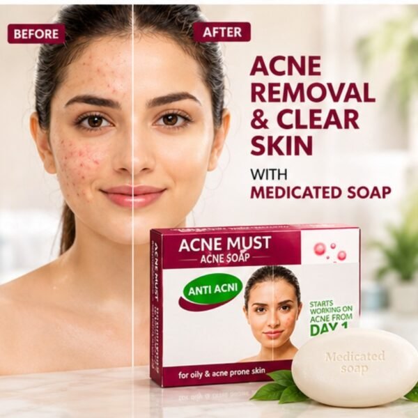 Acne Must Anti-Acne Medicated Soap – Deep Cleansing Soap for Oily & Acne-Prone Skin | Care & Glow